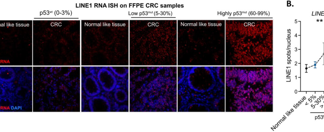 Retrotransposons expression and cell identity